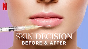 Skin Decision: Before and After (2020)